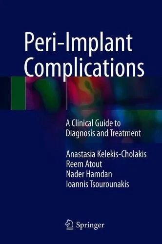 Coperta cărții "Peri-Implant Complications: A Clinical Guide to Diagnosis and Treatment" de autor necunoscut