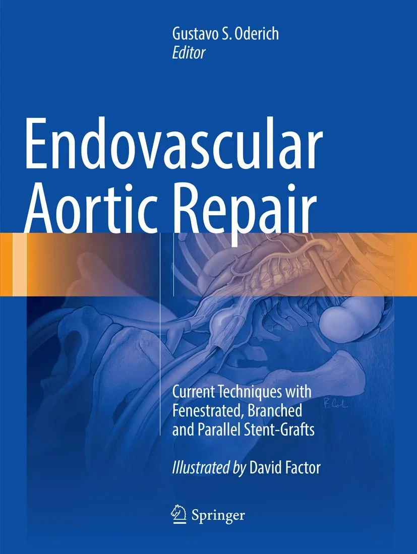 Coperta cărții "Endovascular Aortic Repair: Current Techniques with Fenestrated, Branched and Parallel Stent-Grafts" de autor necunoscut