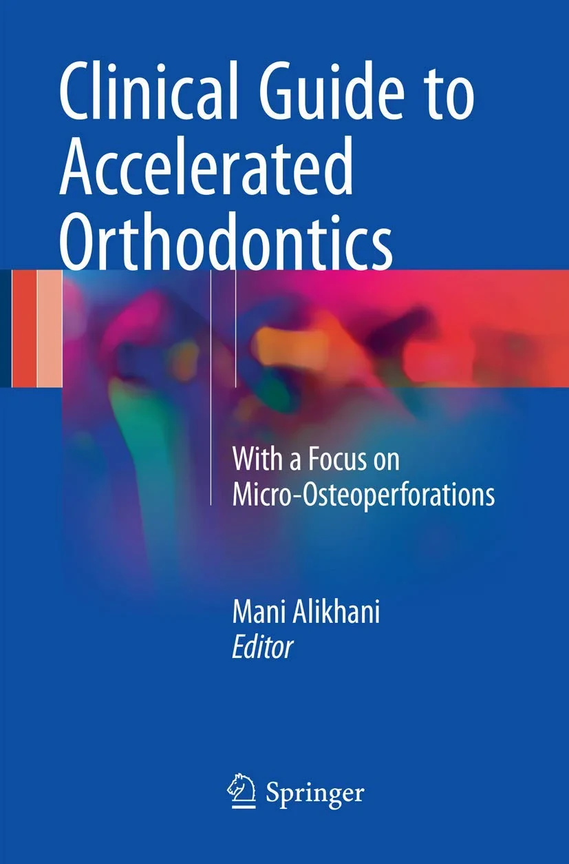 Coperta cărții "Clinical Guide to Accelerated Orthodontics: With a Focus on Micro-Osteoperforations" de autor necunoscut