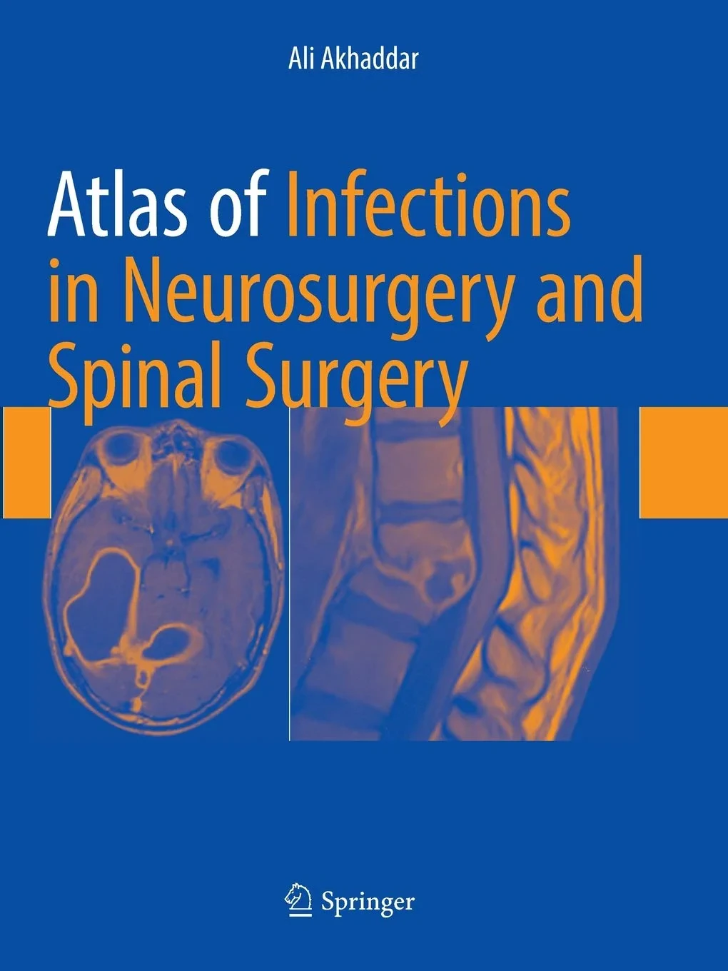 Coperta cărții "Atlas of Infections in Neurosurgery and Spinal Surgery" de autor necunoscut