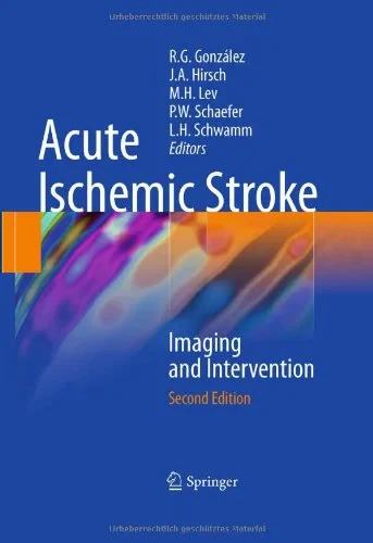 Coperta cărții "Acute Ischemic Stroke: Imaging and Intervention" de autor necunoscut