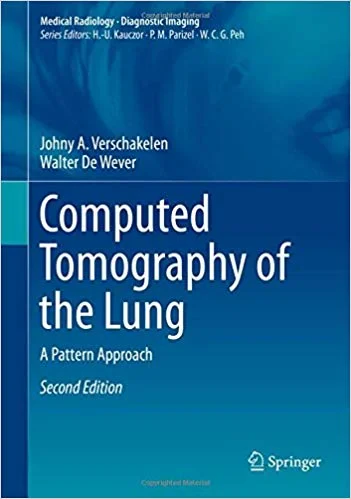 Coperta cărții "Computed Tomography of the Lung: A Pattern Approach" de autor necunoscut