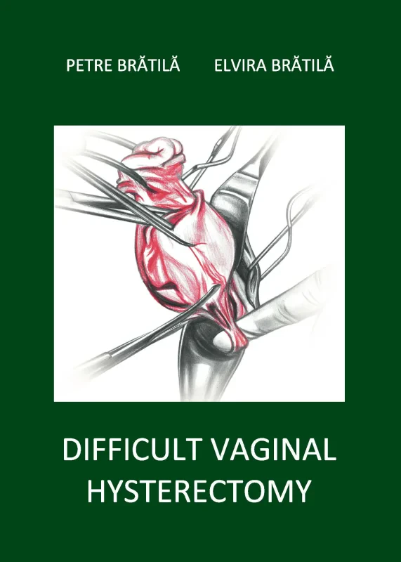 Coperta cărții "Difficult vaginal hysterectomy" de autor necunoscut