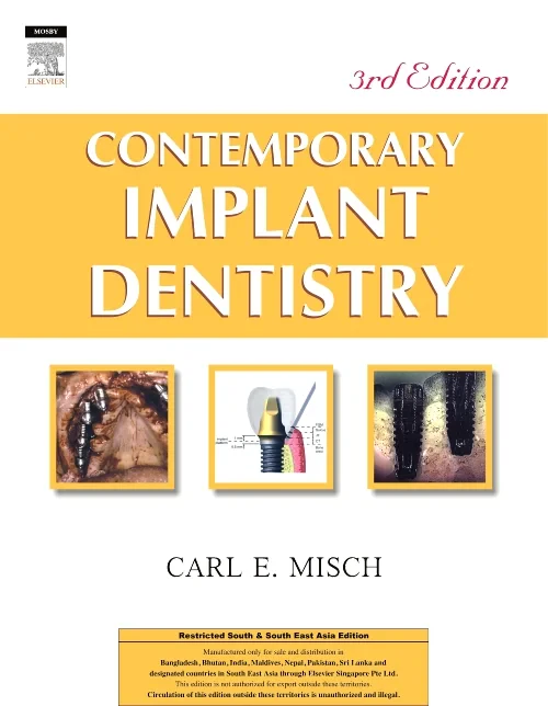 Contemporary Implant Dentistry