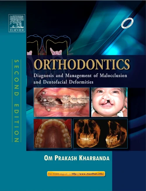 Orthodontics: Diagnosis of & Management of Maloccl...