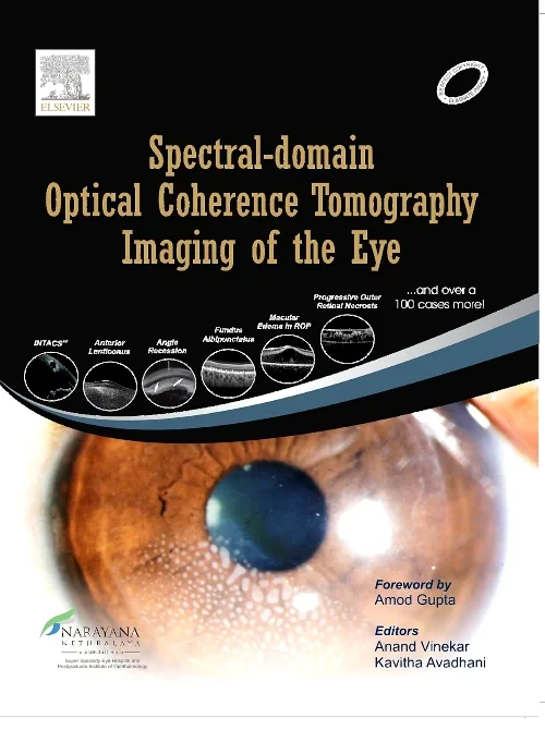 Spectral-domain Optical Coherence Tomography Imagi...
