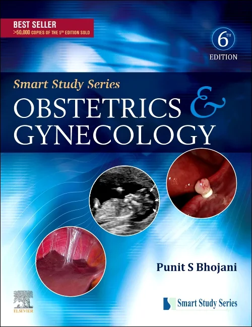 Smart Study Series:Obstetrics & Gynecology