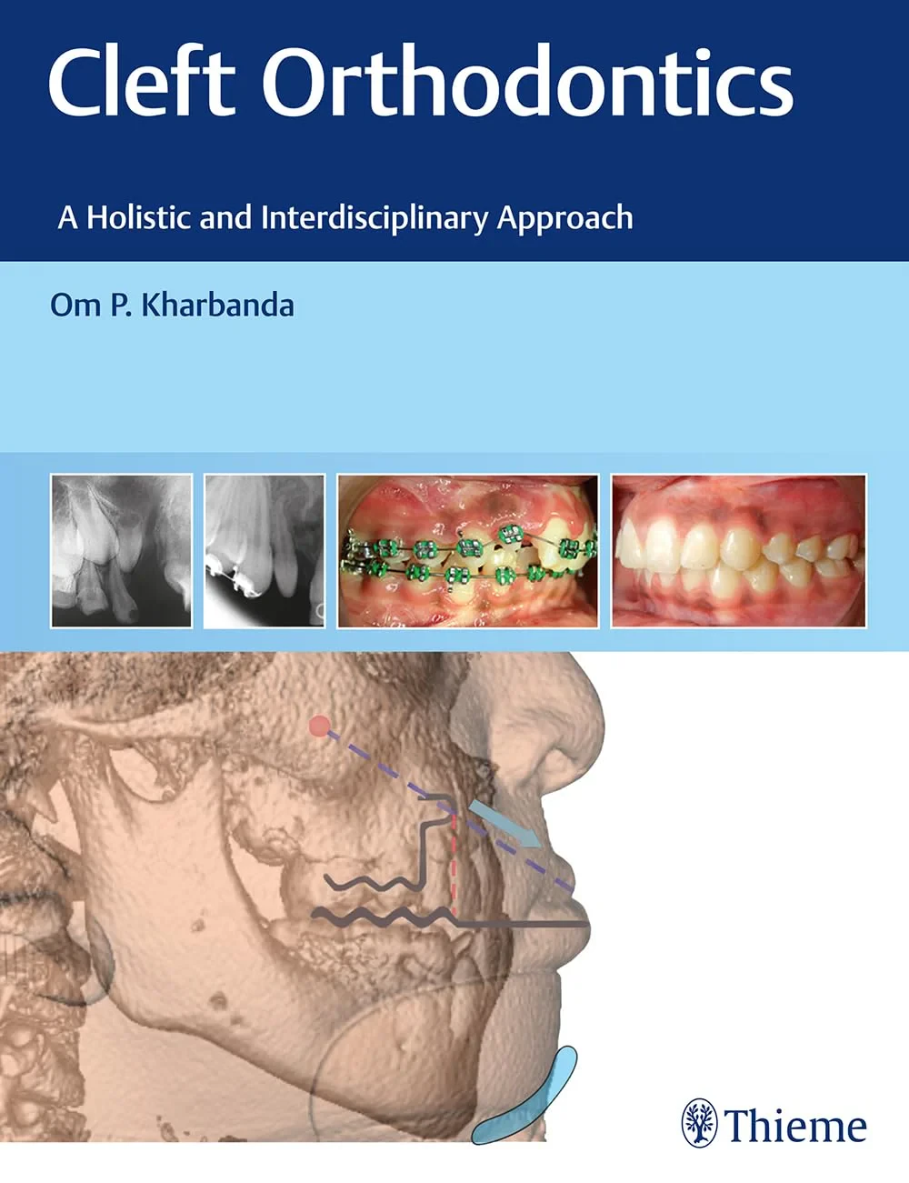 Coperta cărții "Cleft Orthodontics: A Holistic and Interdisciplinary Approach" de autor necunoscut
