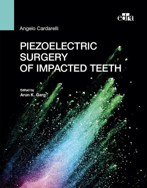 Coperta cărții "Piezoelectric surgery of impacted teeth" de autor necunoscut