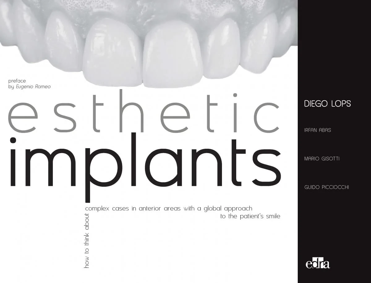 Coperta cărții "Esthetic Implants - 2 books" de autor necunoscut