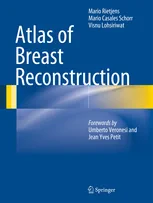 Coperta cărții "Atlas of Breast Reconstruction" de autor necunoscut