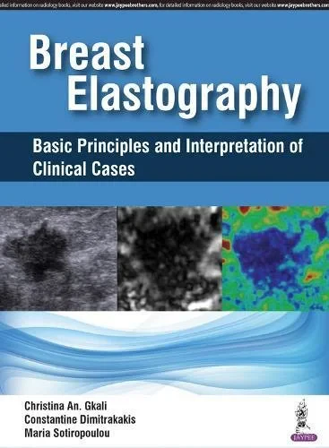 Coperta cărții "Breast Elastography: Basic Principles and Interpretation of Clinical Cases" de autor necunoscut