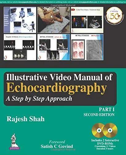Coperta cărții "Illustrative Video Manual of Echocardiography: A Step by Step Approach Part 1- Second Edition" de autor necunoscut