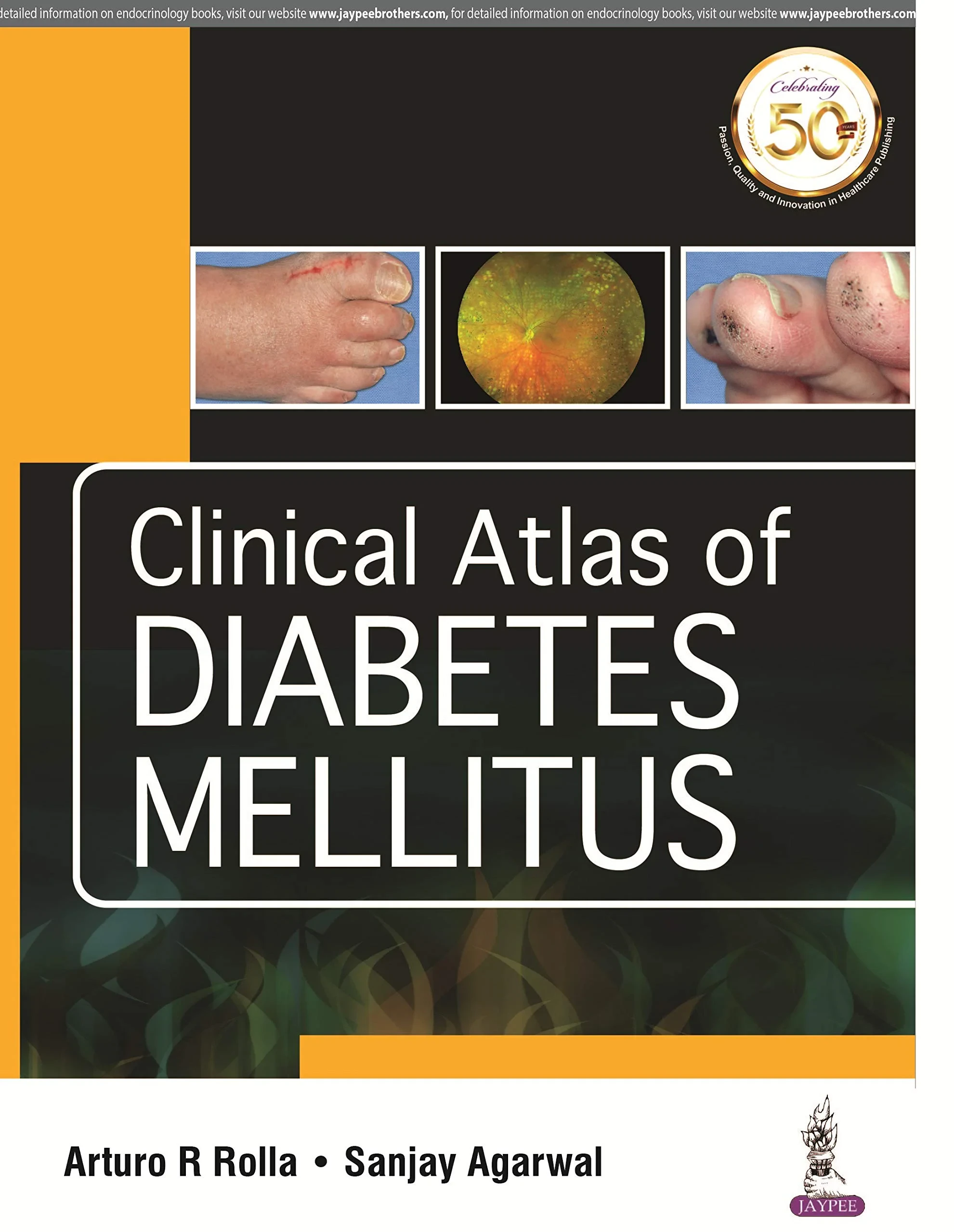 Coperta cărții "Clinical Atlas of Diabetes Mellitus" de autor necunoscut