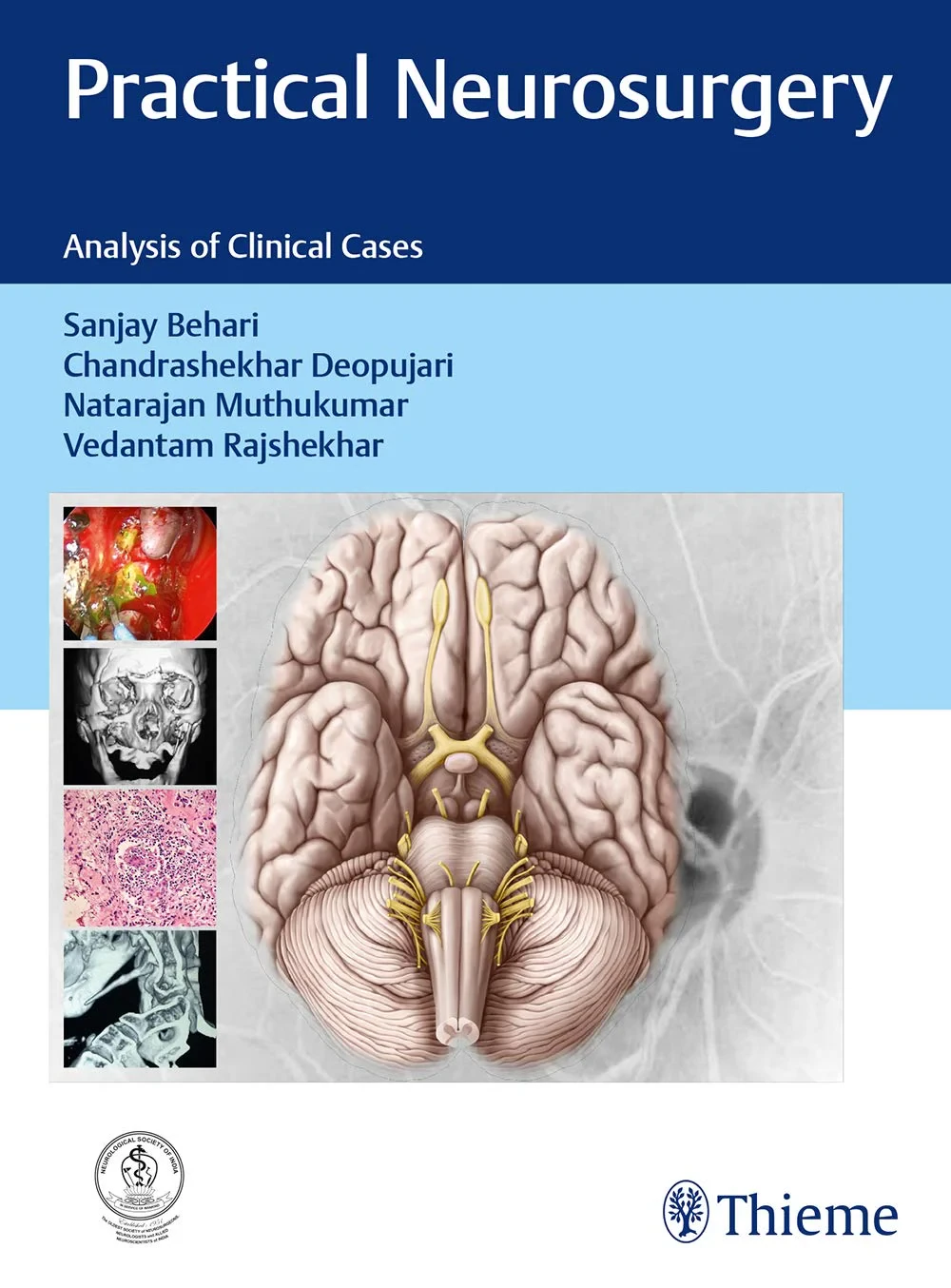 Coperta cărții "Practical Neurosurgery: Analysis of Clinical Cases" de autor necunoscut