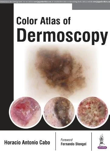 Coperta cărții "Color Atlas of Dermoscopy" de autor necunoscut