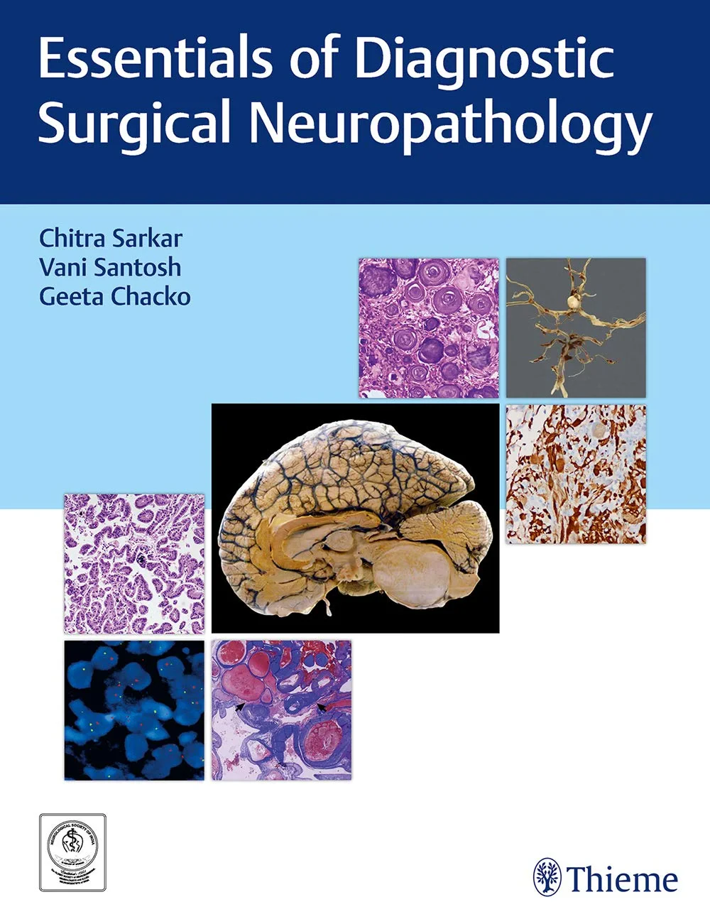 Coperta cărții "Essentials of Diagnostic Surgical Neuropathology" de autor necunoscut