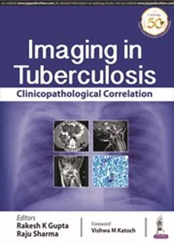 Coperta cărții "Imaging in Tuberculosis" de autor necunoscut
