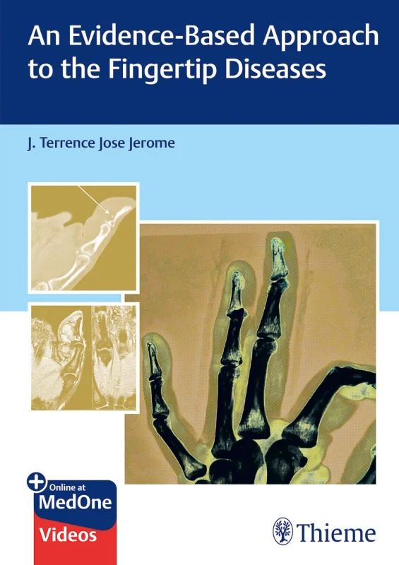 Coperta cărții "An Evidence-Based Approach to the Fingertip Diseases" de autor necunoscut