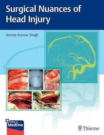 Coperta cărții "Surgical Nuances of Head Injury" de autor necunoscut