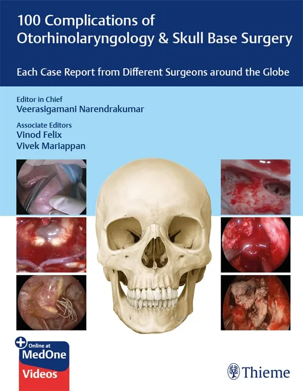 Coperta cărții "100 Complications of Otorhinolangyngology &amp; Skull Base Surgery" de autor necunoscut