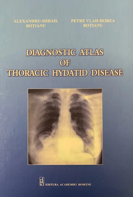 Coperta cărții "Diagnostic atlas of thoracic hydatid disease" de autor necunoscut