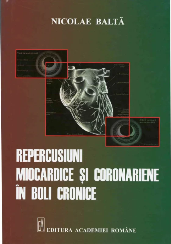 Coperta cărții "Repercusiuni miocardice si coronariene in boli cronice" de autor necunoscut