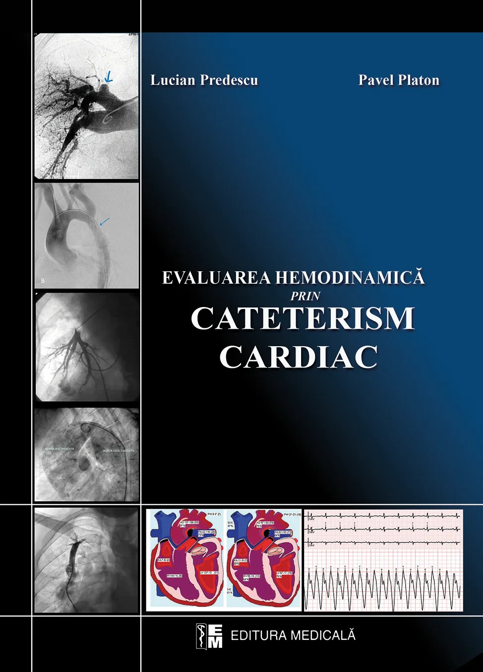 Coperta cărții "Evaluarea hemodinamica prin cateterism cardiac" de autor necunoscut