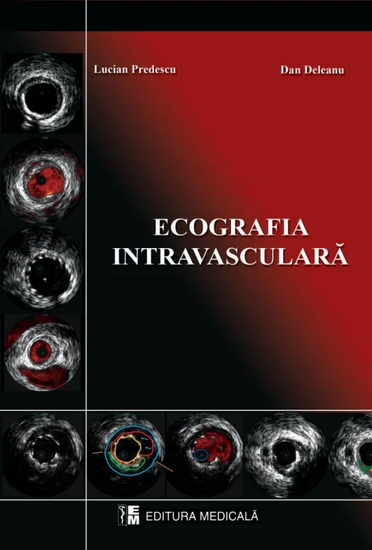 Coperta cărții "Ecografie intravasculara" de autor necunoscut