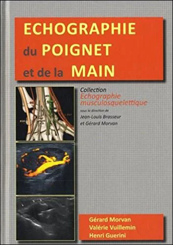 Coperta cărții "ECHOGRAPHIE DU POIGNET ET DE LA MAIN" de autor necunoscut