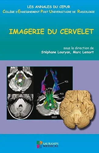 Coperta cărții "IMAGERIE DU CERVELET" de autor necunoscut