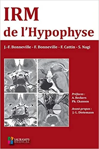 Coperta cărții "IRM DE L&#039;HYPOPHYSE" de autor necunoscut
