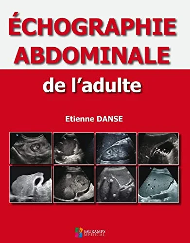 Coperta cărții "ECHOGRAPHIE ABDOMINALE DE L&#039;ADULTE" de autor necunoscut