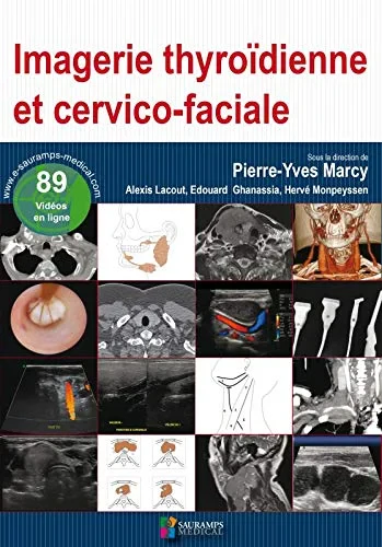Coperta cărții "IMAGERIE THYROIDIENNE ET CERVICO-FACIALE" de autor necunoscut