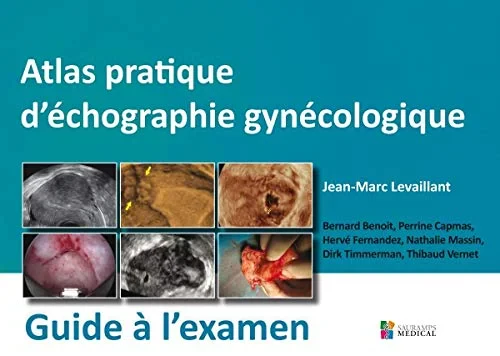 Coperta cărții "ATLAS PRATIQUE D'ECHOGRAPHIE GYNECOLOGIQUE - GUIDE A L'EXAMEN" de autor necunoscut