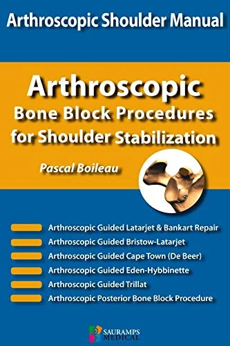 Coperta cărții "ARTHROSCOPIC BONE BLOCK PROCEDURES FOR SHOULDER STABILIZATION" de autor necunoscut