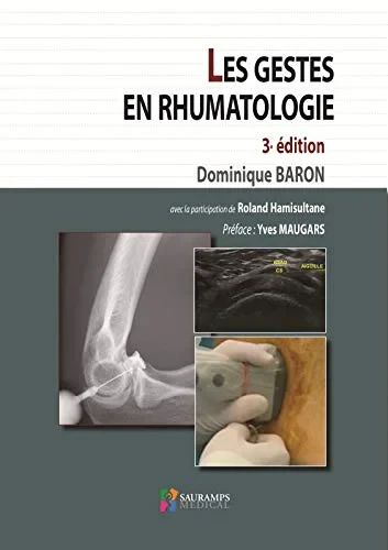 Coperta cărții "LES GESTES EN RHUMATOLOGIE 3�EDITION" de autor necunoscut