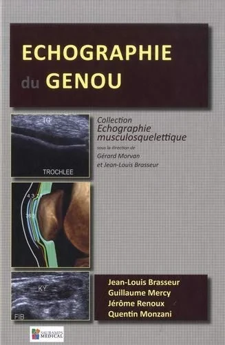 Coperta cărții "ECHOGRAPHIE DU GENOU" de autor necunoscut