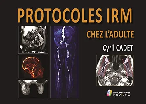 Coperta cărții "PROTOCOLES IRM CHEZ L&#039;ADULTE" de autor necunoscut