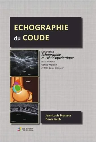 Coperta cărții "ECHOGRAPHIE DU COUDE" de autor necunoscut