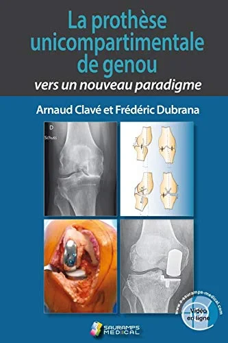 Coperta cărții "LA PROTHESE UNICOMPARTIMENTALE DE GENOU" de autor necunoscut