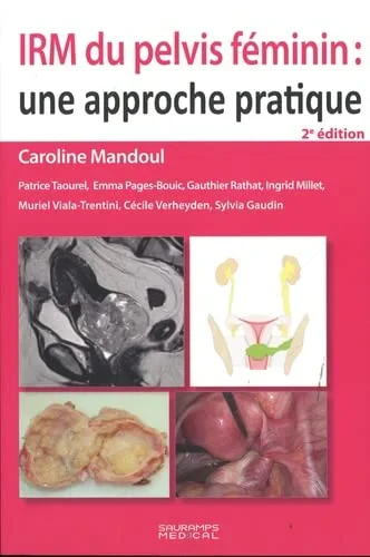 Coperta cărții "IRM DU PELVIS FEMININ : UNE APPROCHE PRATIQUE" de autor necunoscut