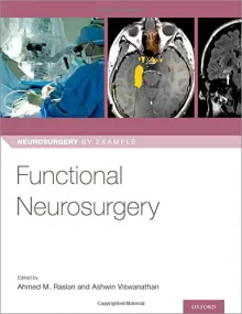Functional Neurosurgery (Neurosurgery by Example)