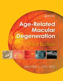 Age-Related Macular Degeneration