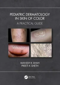 Pediatric Dermatology in Darker Skin