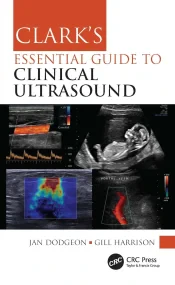 Clarks Essential Guide to Clinical Ultrasoun...