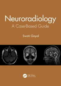 Neuroradiology: A Case-Based Guide