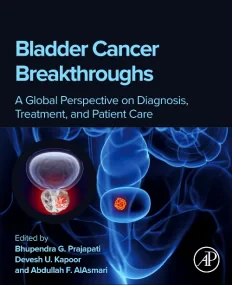 Bladder Cancer Breakthroughs