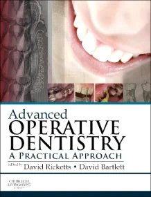 Advanced Operative Dentistry