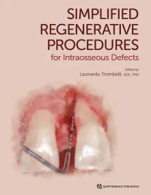 Simplified Regenerative Procedures for Intraosseou...